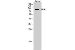 Western Blotting (WB) image for anti-MutL Homolog 1 (MLH1) (Internal Region) antibody (ABIN3185582) (MLH1 anticorps  (Internal Region))