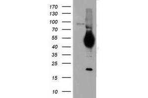 HEK293T cells were transfected with the pCMV6-ENTRY control (Left lane) or pCMV6-ENTRY CD5 (Right lane) cDNA for 48 hrs and lysed. (CD5 anticorps)