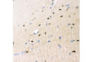 IHC analysis of Crk p38 using anti-Crk p38 antibody (ABIN3042758). (Crk anticorps  (AA 2-246))