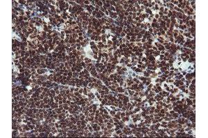 Image no. 11 for anti-Replication Factor C (Activator 1) 2, 40kDa (RFC2) (AA 1-234) antibody (ABIN1490617)