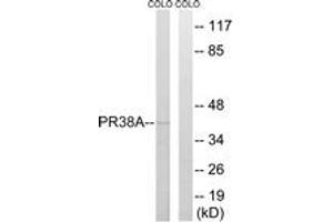Western blot analysis of extracts from COLO cells, using PRPF38A Antibody.