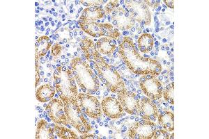 Immunohistochemistry of paraffin-embedded rat kidney using HMGCL antibody. (HMGCL anticorps)