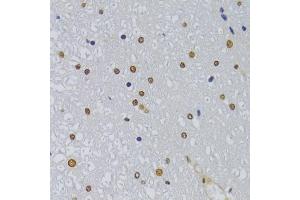Immunohistochemistry of paraffin-embedded rat spinal cord using HNRNPA1 Antibody (ABIN5975570) at dilution of 1/100 (40x lens). (HNRNPA1 anticorps)