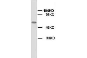 Western blot on Rat skeletal muscle lysis using AP23320PU-N CHRNA1 antibody. (CHRNA1 anticorps  (N-Term, Subunit alpha))