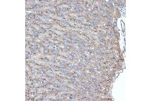 Immunohistochemistry of paraffin-embedded mouse liver using SR-B2/SR-B2/LIMPII Rabbit mAb (ABIN7270157) at dilution of 1:100 (40x lens). (SCARB2 anticorps)