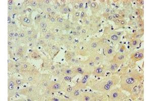 Immunohistochemistry of paraffin-embedded human liver tissue using ABIN7150482 at dilution of 1:100 (POLR1D anticorps  (AA 1-133))