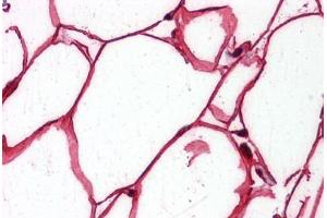 Human Adipocytes: Formalin-Fixed, Paraffin-Embedded (FFPE)