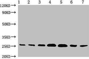 Western Blot Positive WB detected in: 1.