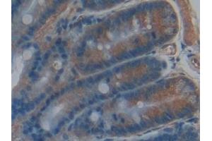 Detection of CYP-40 in Rat Intestine Tissue using Polyclonal Antibody to Cyclophilin 40 (CYP-40)