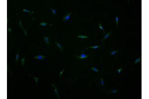 Immunofluorescence staining of U251 cells with ABIN7167254 at 1:100, counter-stained with DAPI. (RAB23 anticorps  (AA 18-234))