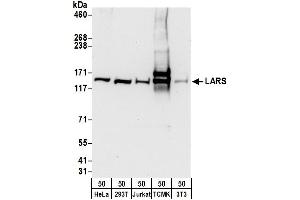 anti-Leucyl-tRNA Synthetase (LARS) (AA 1-50) antibody