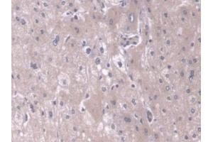 Detection of TOMM70A in Human Liver Tissue using Polyclonal Antibody to Translocase Of Outer Mitochondrial Membrane 70A (TOMM70A)