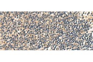 Immunohistochemistry of paraffin-embedded Human tonsil tissue using CNST Polyclonal Antibody at dilution of 1:60(x200) (CNST anticorps)