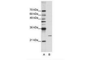 Image no. 2 for anti-Processing of Precursor 4, Ribonuclease P/MRP Subunit (POP4) (C-Term) antibody (ABIN202077) (RPP29 anticorps  (C-Term))