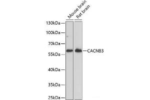 Western blot analysis of extracts of various cell lines using CACNB3 Polyclonal Antibody at dilution of 1:1000. (CACNB3 anticorps)
