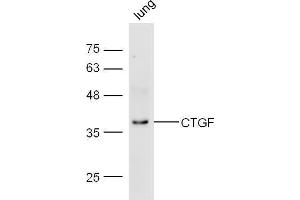 Mouse lung lysate probed with Anti-CTGF Polyclonal Antibody  at 1:5000 90min in 37˚C.