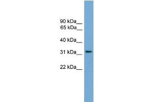 Human COLO205; WB Suggested Anti-CCDC117 Antibody Titration: 0. (CCDC117 anticorps  (C-Term))
