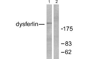 Western blot analysis of extracts from K562 cells, using Dysferlin antibody. (Dysferlin anticorps)