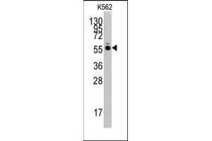 Western blot analysis of anti-HARS Pab in K562 cell line lysates (35ug/lane). (HARS1/Jo-1 anticorps  (N-Term))