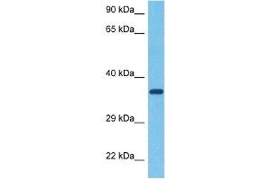 Host:  Rabbit  Target Name:  ASGR1  Sample Tissue:  Human Ovary Tumor  Antibody Dilution:  1ug/ml
