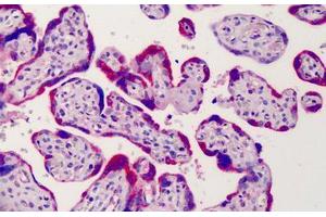 Human Placenta: Formalin-Fixed, Paraffin-Embedded (FFPE) (ADAM12 anticorps  (AA 2-14))