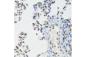 Immunohistochemistry of paraffin-embedded mouse lung using BAZ1B antibody. (BAZ1B anticorps  (AA 1-260))