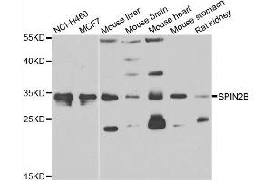 Western blot analysis of extracts of various cell lines, using SPIN2B antibody. (Spindlin 2B anticorps)