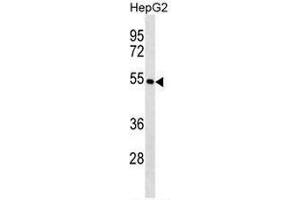 KRT26 Antibody (N-term) western blot analysis in HepG2 cell line lysates (35µg/lane). (Keratin 26 anticorps  (N-Term))