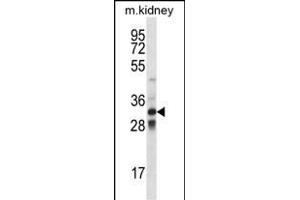 TLX1 Antibody (Center) (ABIN656421 and ABIN2845712) western blot analysis in mouse kidney tissue lysates (35 μg/lane). (TLX1 anticorps  (AA 163-191))