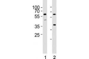 Western blot analysis of lysate from 1) HT-29 and 2) K562 cell lines using RIPK3 antibody at 1:1000. (RIPK3 anticorps  (AA 61-91))