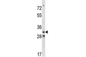 Cdk4 antibody western blot analysis in mouse NIH3T3 lysate. (CDK4 anticorps  (AA 219-246))