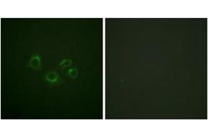 Immunofluorescence analysis of A549 cells, using EPHA2/3/4 (Ab-588/596) Antibody. (EPHA2/3/4 anticorps  (AA 556-605))