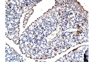Formalin-fixed and paraffin embedded rat pancreatic tissue labeled with Anti-GIP Polyclonal Antibody, Unconjugated (ABIN724850) at 1:200, followed by conjugation to the secondary antibody and DAB staining (GIP anticorps  (AA 52-93))