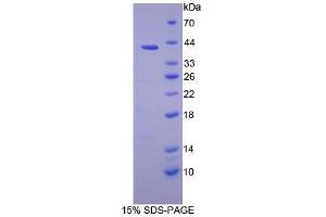 SDS-PAGE analysis of Human PSMD7 Protein. (PSMD7 Protéine)