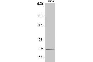 Western Blotting (WB) image for anti-Solute Carrier Family 6 (Neurotransmitter Transporter, Creatine), Member 8 (SLC6A8) (C-Term) antibody (ABIN3186976)