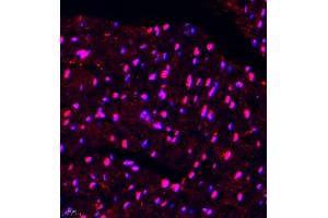 Immunofluorescence of paraffin embedded mouse heart using DGKI (ABIN7073721) at dilution of 1:650 (400x lens) (DGKI anticorps)