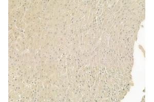 ABIN6266026 and ABIN6277560 at 1/100 staining human normal liver tissue by IHC-P. (WIF1 anticorps  (Internal Region))