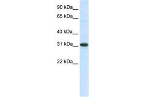 Western Blotting (WB) image for anti-Nuclear Receptor Interacting Protein 2 (NRIP2) antibody (ABIN2461500) (NRIP2 anticorps)