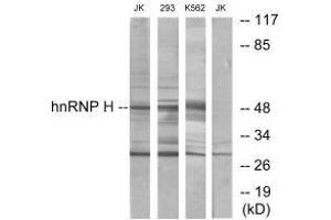 Western blot analysis of extracts from Jurkat cells, 293 cells and K562 cells, using hnRNP H antibody. (HNRNPH2 anticorps)