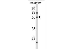 DOK7 Antibody (N-term) (ABIN657491 and ABIN2846518) western blot analysis in mouse spleen tissue lysates (35 μg/lane). (DOK7 anticorps  (N-Term))