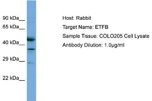 Host: Rabbit Target Name: ETFB Sample Tissue: Human COLO205 Whole Cell Antibody Dilution: 1ug/ml (ETFB anticorps  (C-Term))