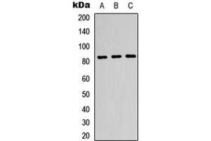 Western blot analysis of Beta-glucuronidase expression in K562 (A), HeLa (B), HepG2 (C) whole cell lysates. (Glucuronidase beta anticorps  (Center))