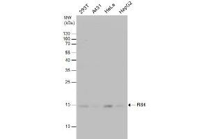 WB Image FIS1 antibody detects FIS1 protein by western blot analysis.