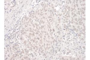 Immunohistochemistry (IHC) image for anti-Poly-U Binding Splicing Factor 60KDa (PUF60) (AA 1-50) antibody (ABIN7453766)