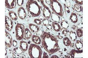 Image no. 10 for anti-serpin Peptidase Inhibitor, Clade B (Ovalbumin), Member 1 (SERPINB1) (AA 77-306) antibody (ABIN1491671)