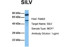 Host:  Rabbit  Target Name:  SILV  Sample Tissue:  Human MCF7  Antibody Dilution:  1. (Melanoma gp100 anticorps  (N-Term))