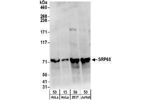 Western Blotting (WB) image for anti-Signal Recognition Particle 68kDa (SRP68) (AA 1-50) antibody (ABIN7450775) (SRP68 anticorps  (AA 1-50))