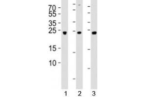 Western blot analysis of lysate from 1) 293, 2) SW620, and 3) U-87 MG cell line using UCHL3 antibody at 1:1000. (UCHL3 anticorps  (AA 195-225))