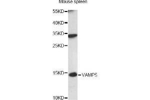 Western blot analysis of extracts of mouse spleen, using VAMP5 antibody (ABIN6292345) at 1:3000 dilution. (VAMP5 anticorps)
