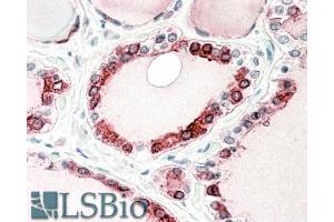 ABIN768643 (5µg/ml) staining of paraffin embedded Human Thyroid Gland. (Thyroperoxidase anticorps  (C-Term))